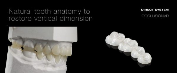 edelweiss occlusion VD veneer forms from DPS