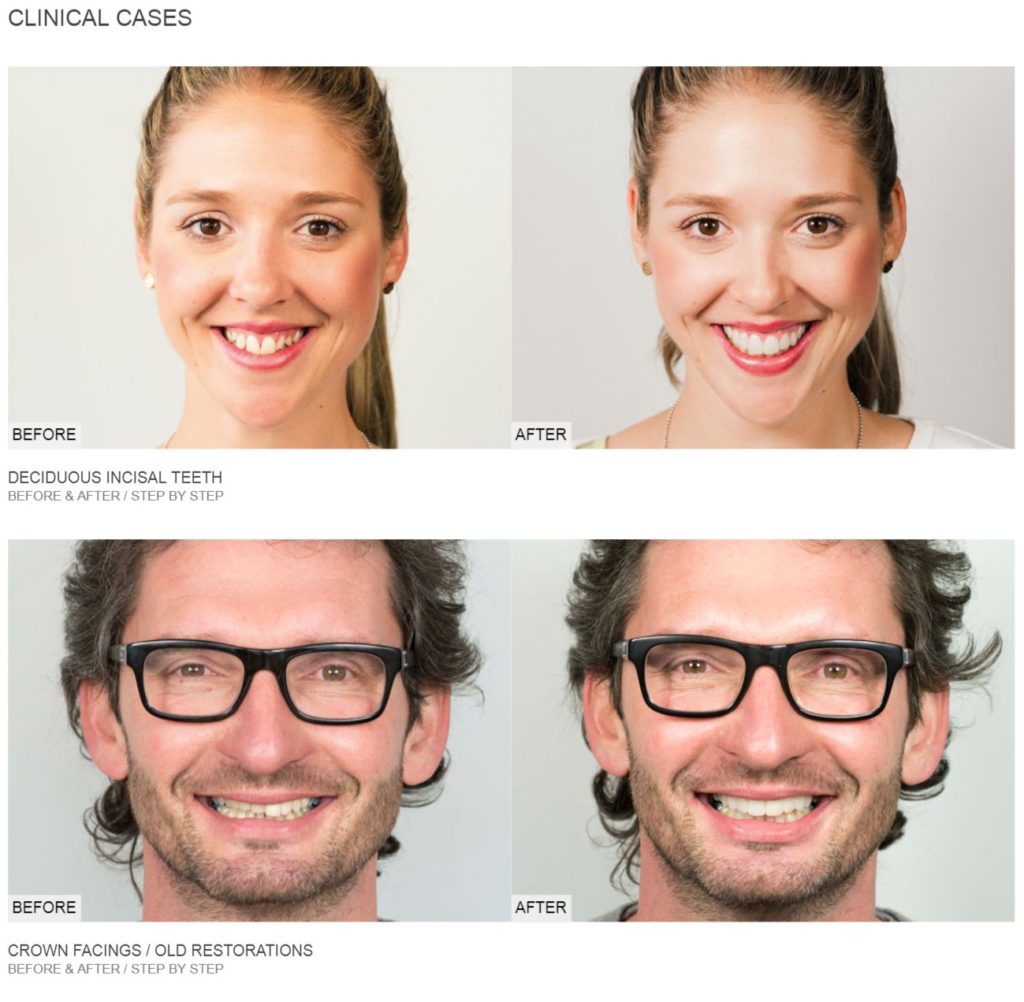 edelweiss Dentistry Clinical Case Studies Dental Practice Systems