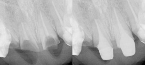 Dental X-rays