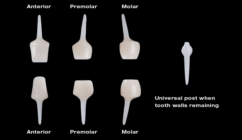 edelweiss dental POST & CORE Product Range