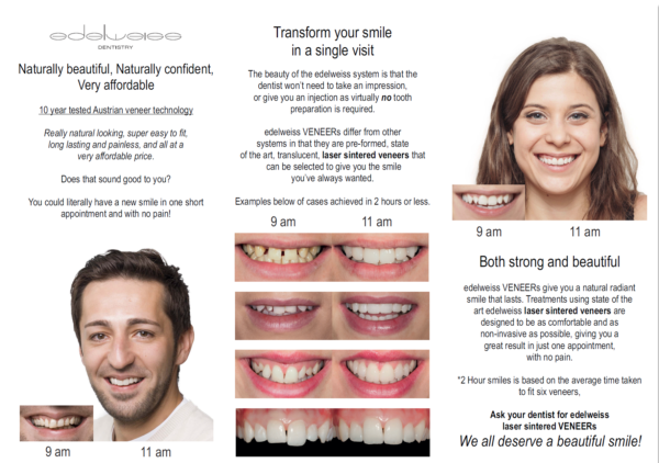 before/after dental comparison