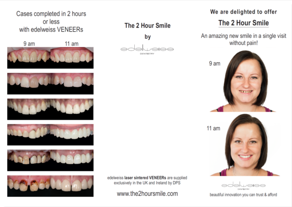 before/after dental comparison