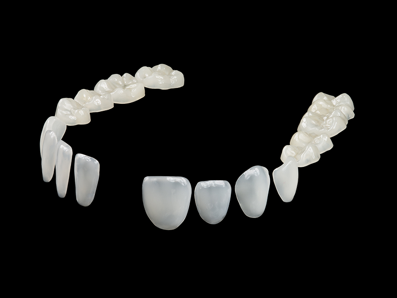 dentistry veneers and occlusion VDs