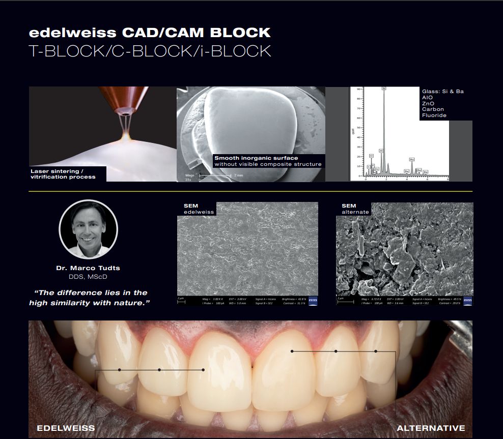 edelweiss CAD/CAM Blocks from DPS