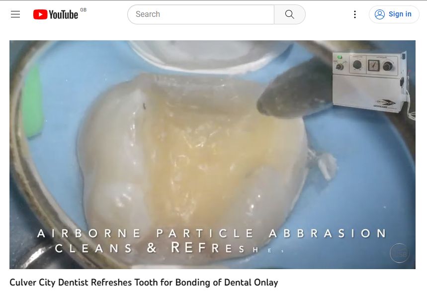 Crystalair Air Abrasion from DPS for improved bonding. Minimal invasive, no anaesthetic dentistry.