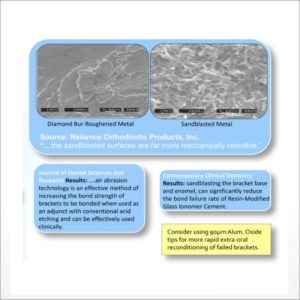 Black Abrasive EtchMaster Tips from DPS