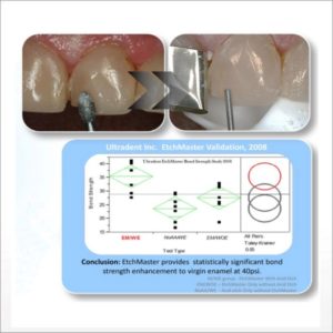 EtchMaster Air abrasion and prophy tips